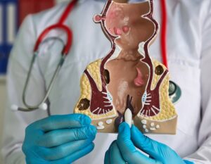 Clínica de Proctología y Cirugía del Aparato Digestivo